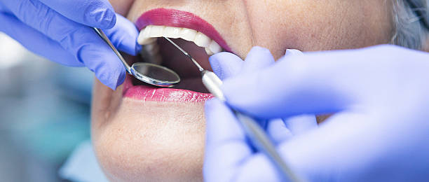 Best Emergency Dentist for Knocked-Out Tooth in Murphy, MO